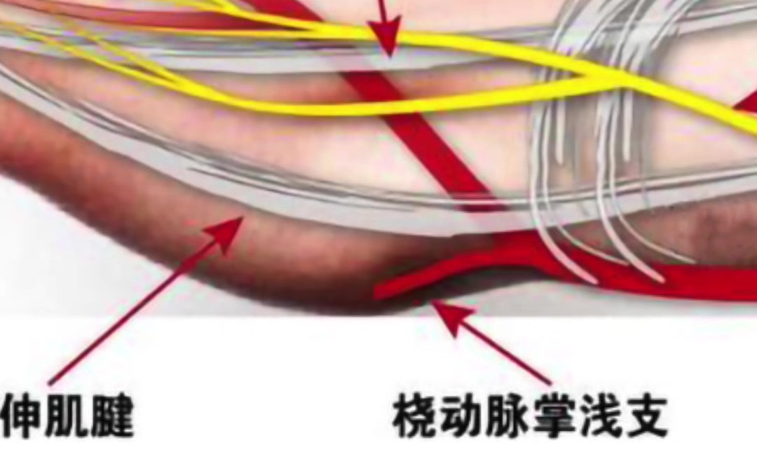 [图]心脏搭桥都听过，这个“桥”是怎么搭起来的你知道吗？