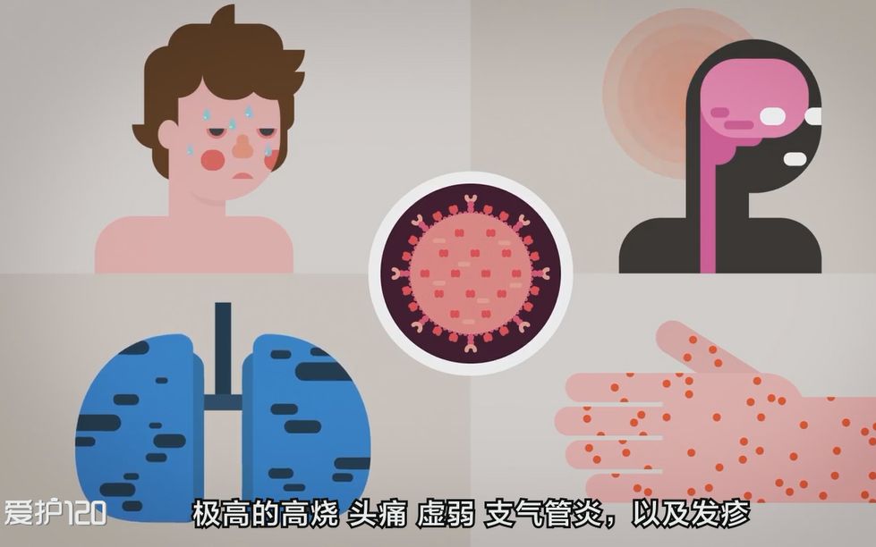 麻疹病毒入侵人体全过程,危害四大器官破坏免疫系统