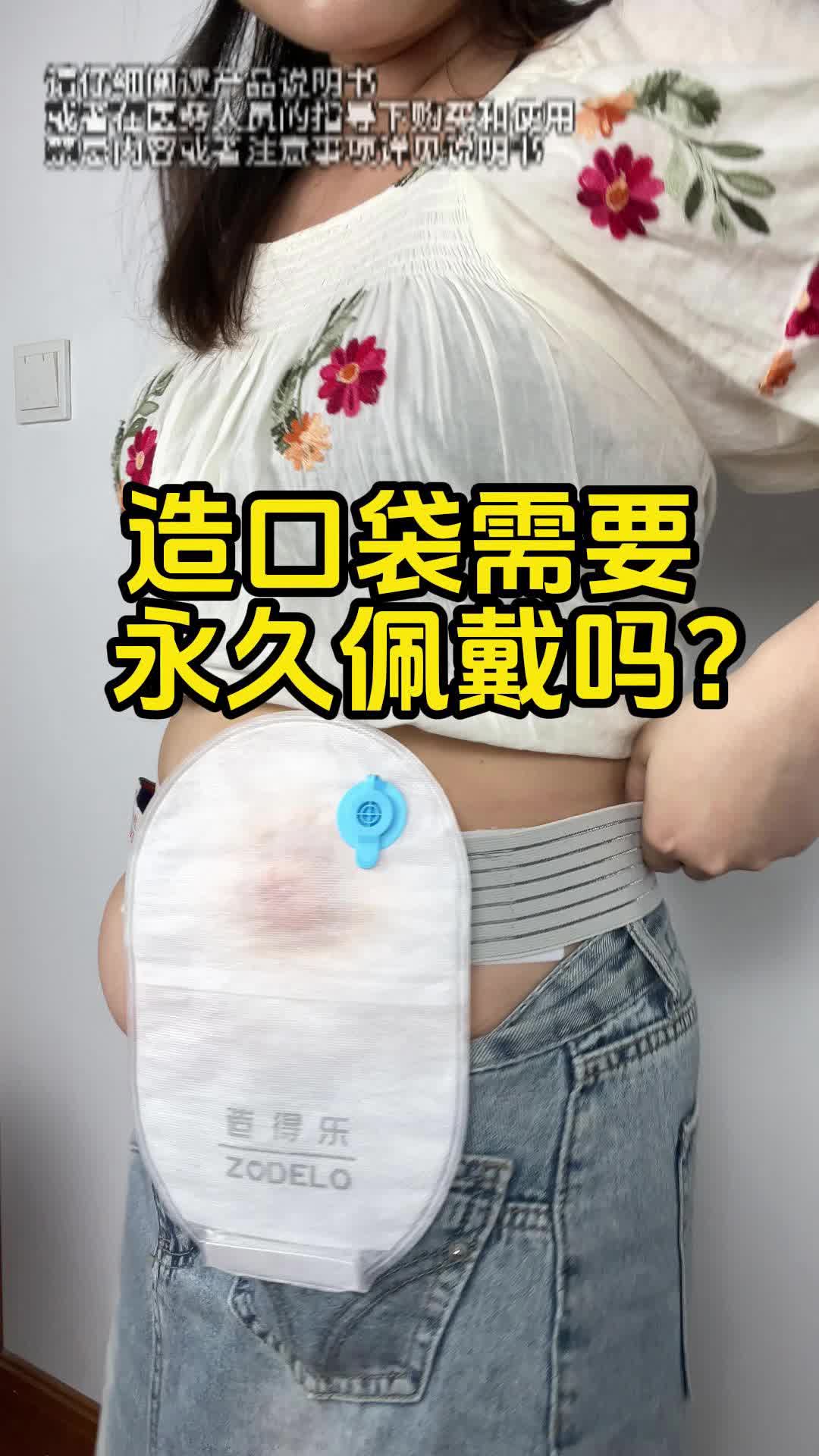 造口袋需要永久佩戴吗?哔哩哔哩bilibili