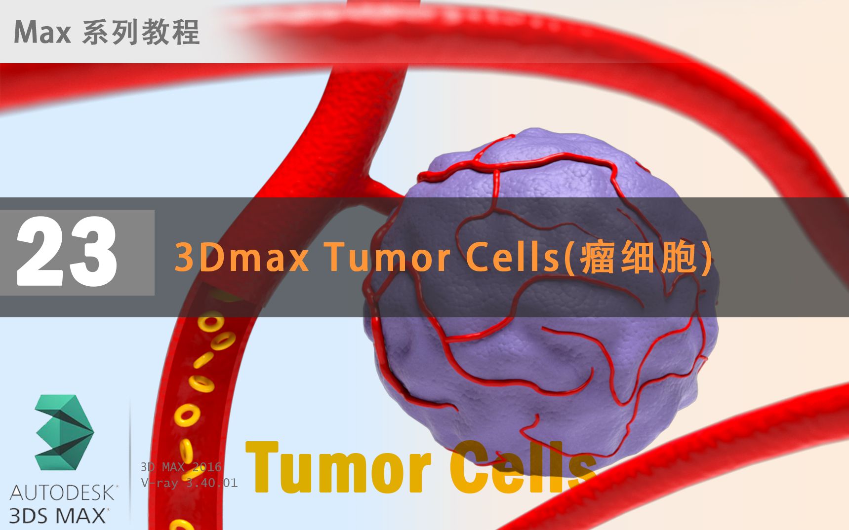 3dmax tumor cells(瘤细胞)_哔哩哔哩 (゜-゜)つロ 干杯~-bilibili