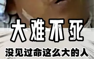 Download Video: 一把刀子插入大脑，老哥居然还完好无恙的生活！#搞笑 #离谱 #骚操作