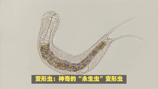 变形虫:变形虫具有一种特殊的细胞器,称为伪足,这是它们进行运动和