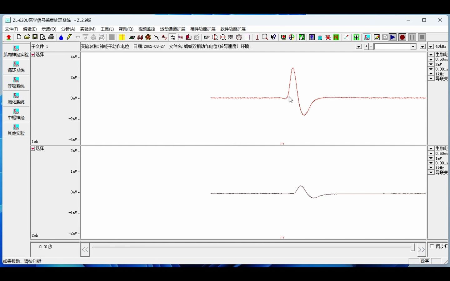 医学信号采集处理系统神经干双向动作电位哔哩哔哩bilibili