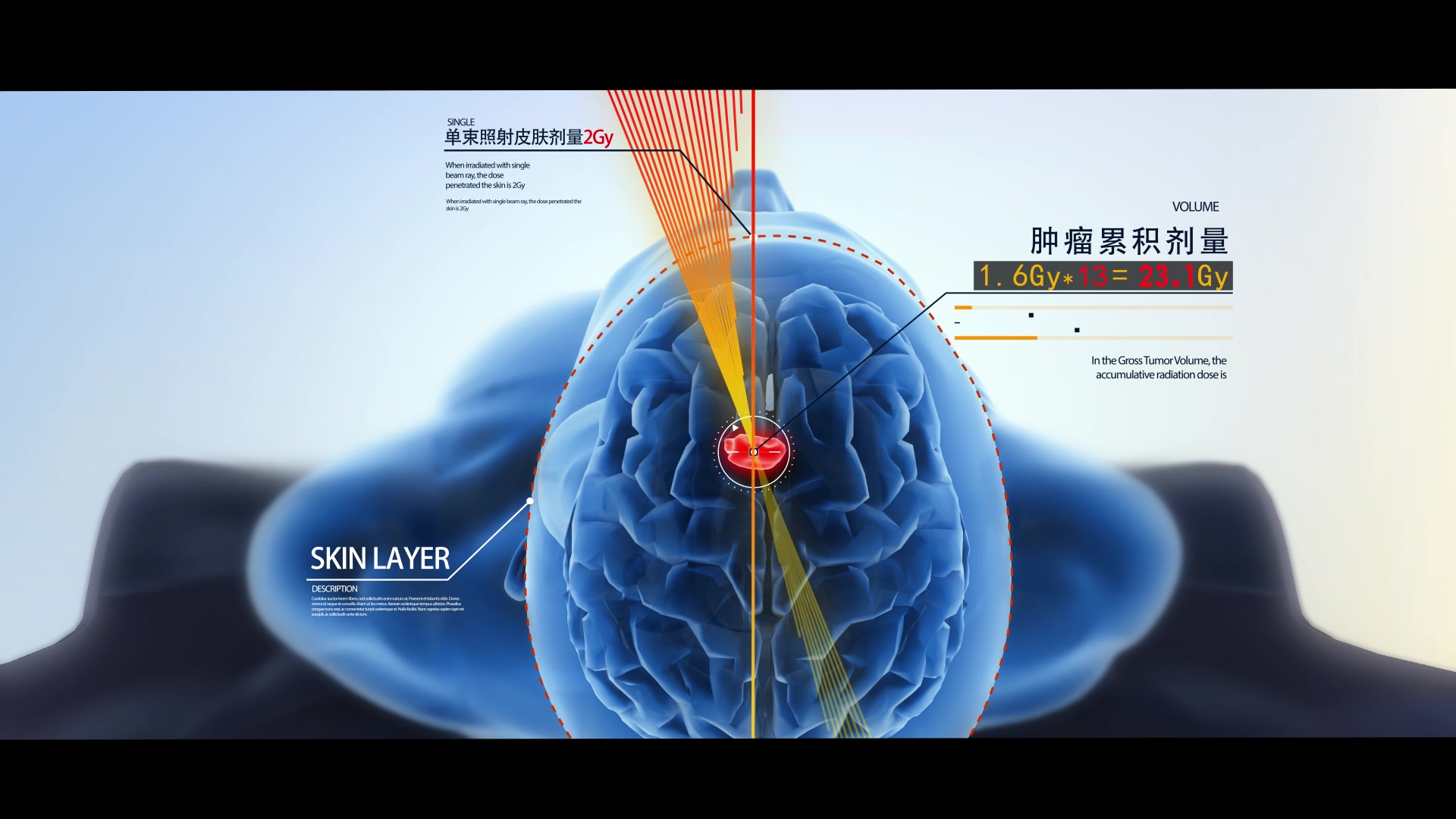 三维产品医疗设备动画
