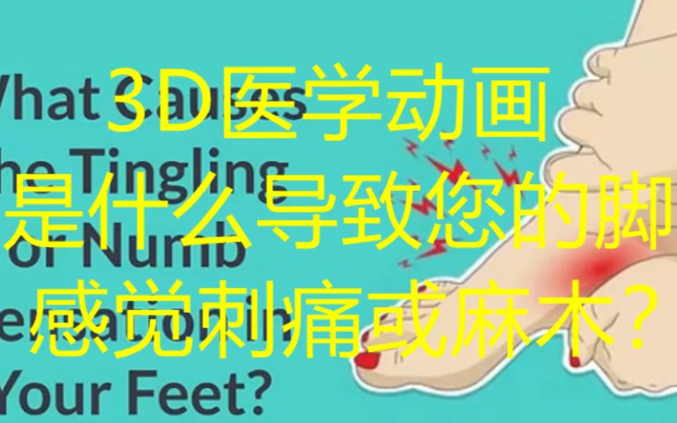 是什么导致您的脚感觉刺痛或麻木?3D医学动画科普哔哩哔哩bilibili