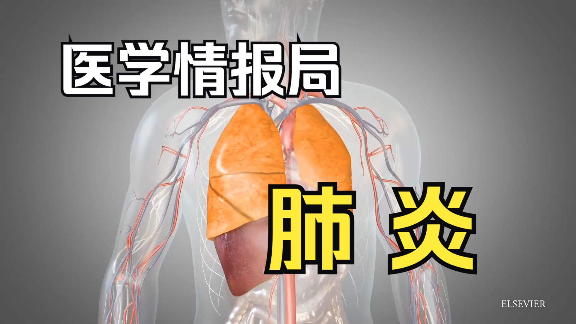 【医学情报局】肺炎 Pneumonia哔哩哔哩bilibili