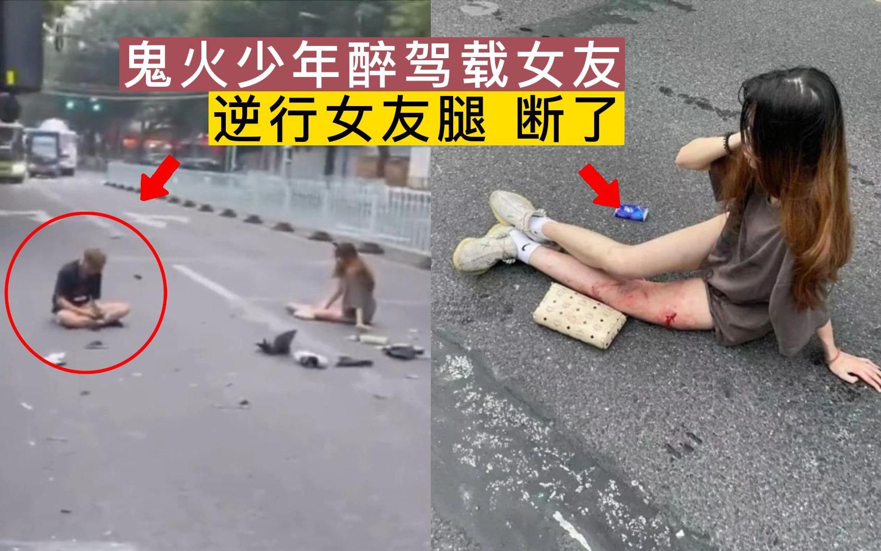 [图]挖槽！鬼火少年酒后作死，载女友逆行，妹子腿断了