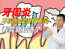 Video herunterladen: 牙周炎要拔掉吗，不同阶段治疗方法不同！