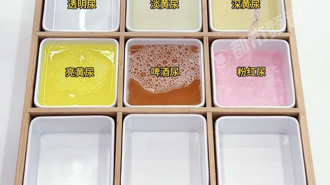 医生30秒带你了解，九种尿液颜色分别代表什么？网友：我一直以为喝水喝到透明是比较健康的