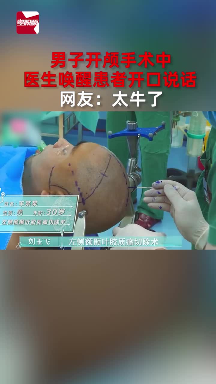 男子开颅手术中,医生唤醒患者开口说话,网友:太牛了哔哩哔哩bilibili