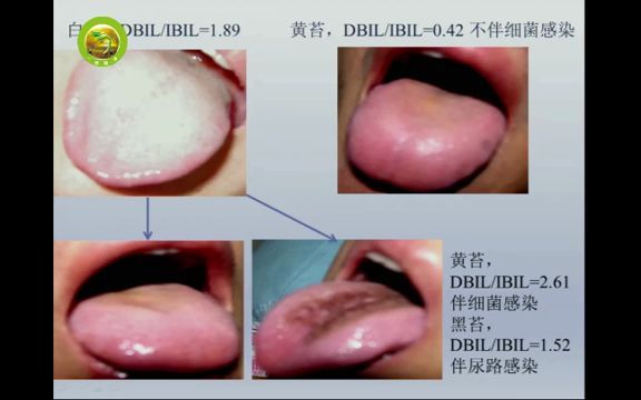 中医基础方剂学太阳病类方(上)4 吴雄志老师哔哩哔哩bilibili