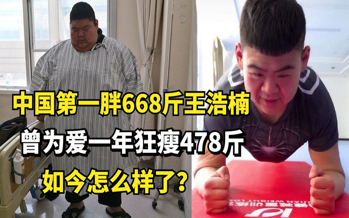 中国第一胖668斤王浩楠:曾为爱一年狂瘦478斤,如今怎么样了?哔哩哔哩bilibili