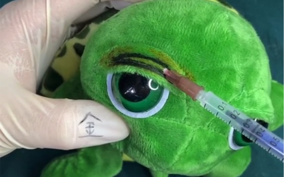 乌龟做完双眼皮前女友都回来了