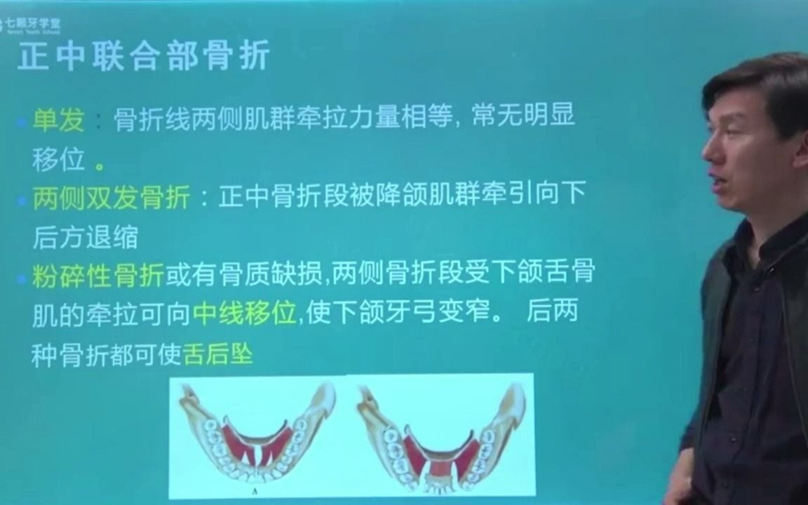 口腔执业助理大圣直播:正中联合部骨折七颗牙学堂