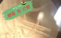 【热带鱼】腮霉病 烂鳃病 (疾病篇2)哔哩哔哩bilibili