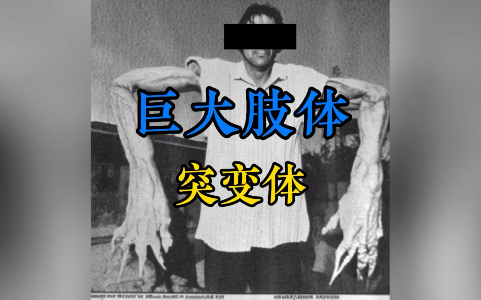 [图]1994 年，在墨西哥进行了调查期间，在一个被遗忘的小镇，居民中患有一种奇怪的疾病