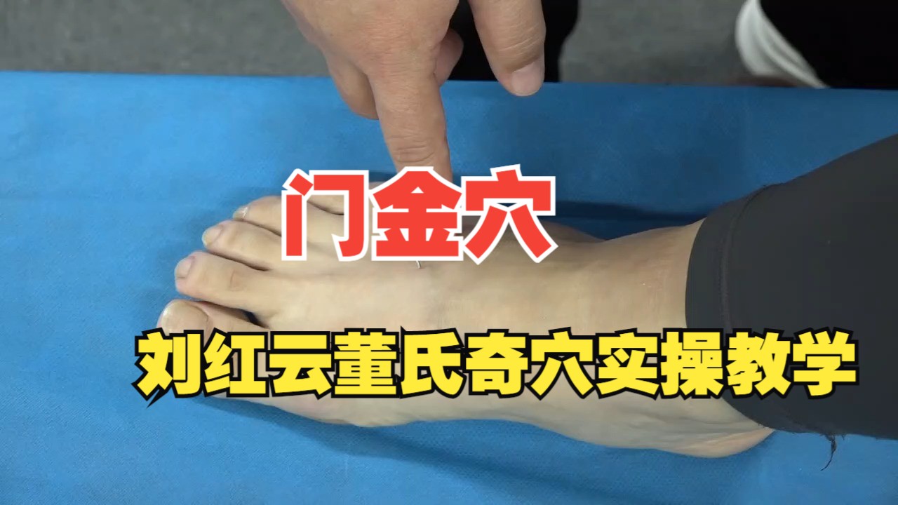 门金穴,刘红云董氏奇穴实操教学