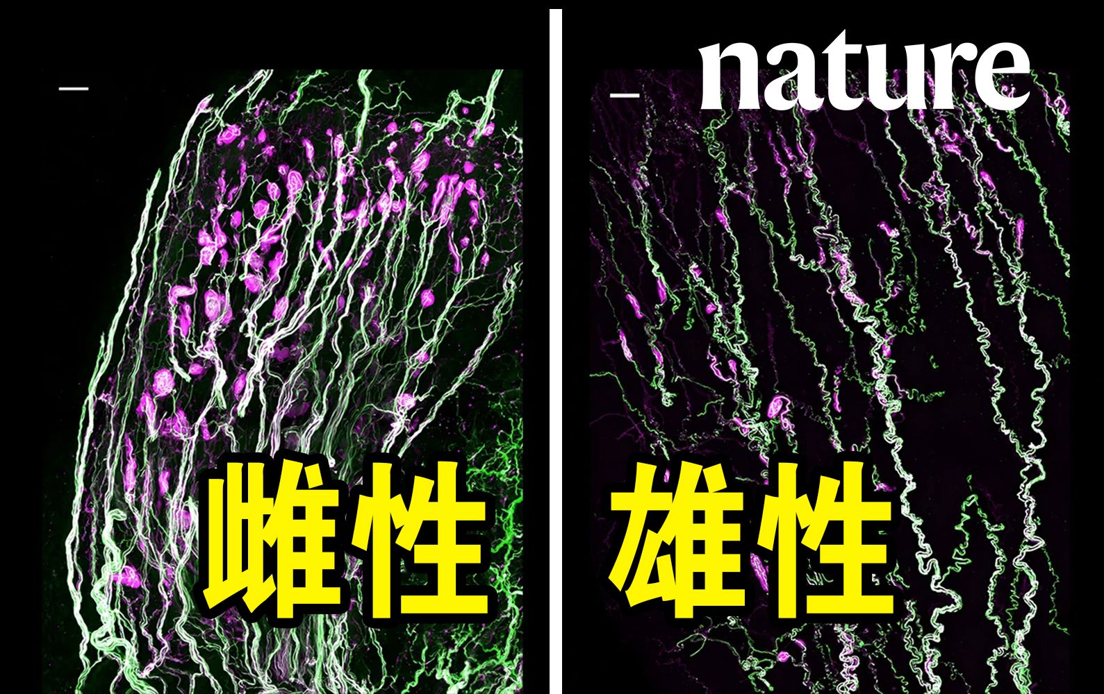 揭秘性器官振动感知器的神经科学雌性密度是雄性的15倍哔哩哔哩bilibili