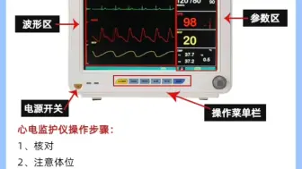 Download Video: 你会看心电监护仪吗？