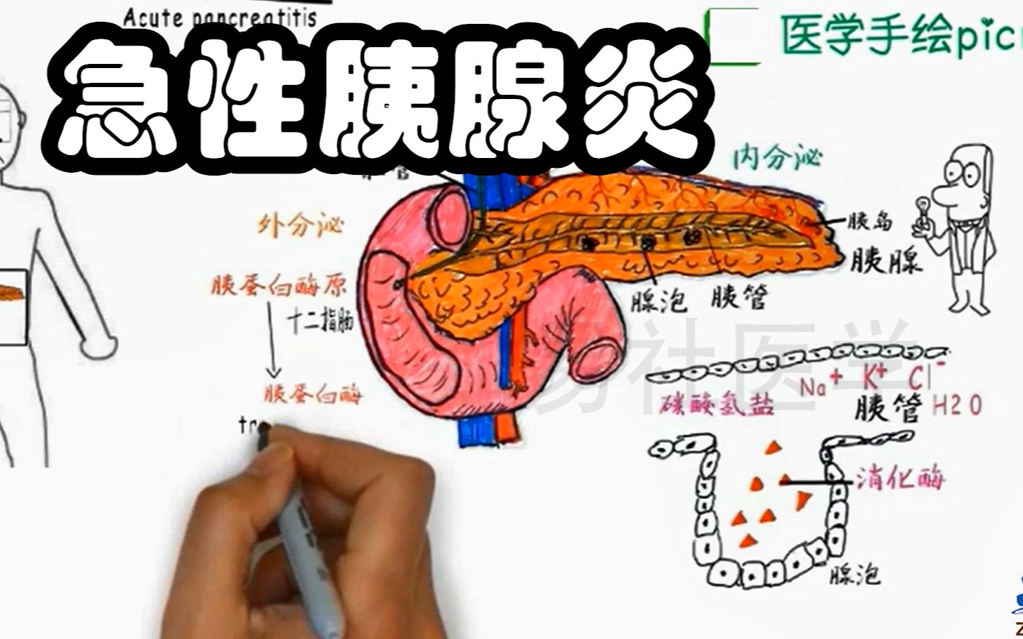 [图]医学生动画演绎 内科学考点 急性胰腺炎