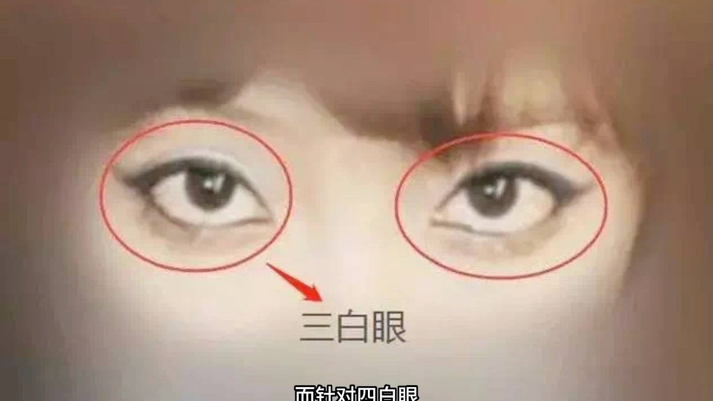 “三白眼”跟“四白眼”有何不同之处?哔哩哔哩bilibili