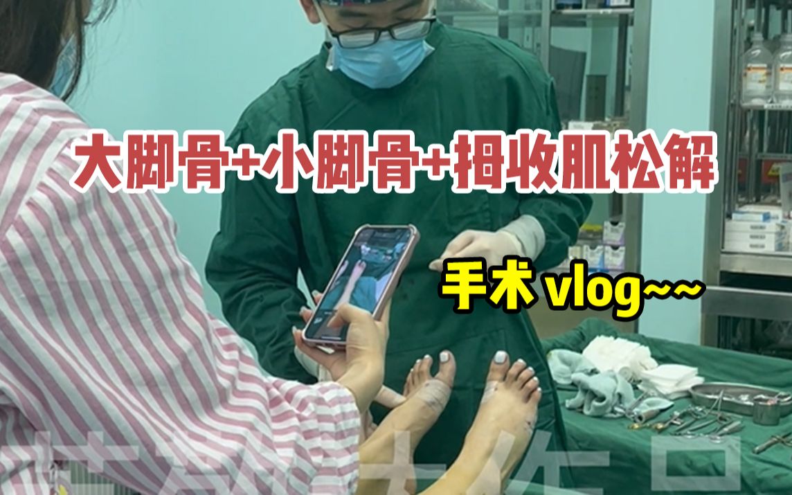 【苏敬达】32岁来做大脚骨手术,花3w做完真的"贼好看!