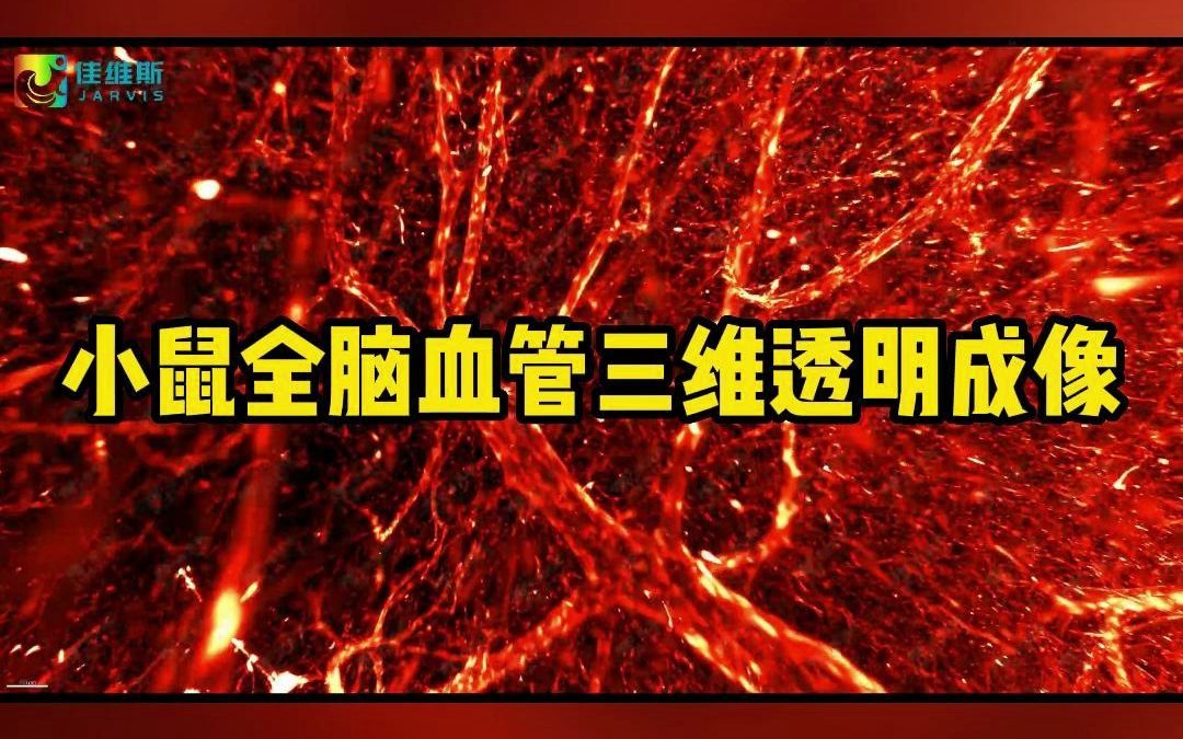 小鼠全脑血管三维透明成像 小鼠脑血管三维结构 小鼠脑透明化三维成像哔哩哔哩bilibili