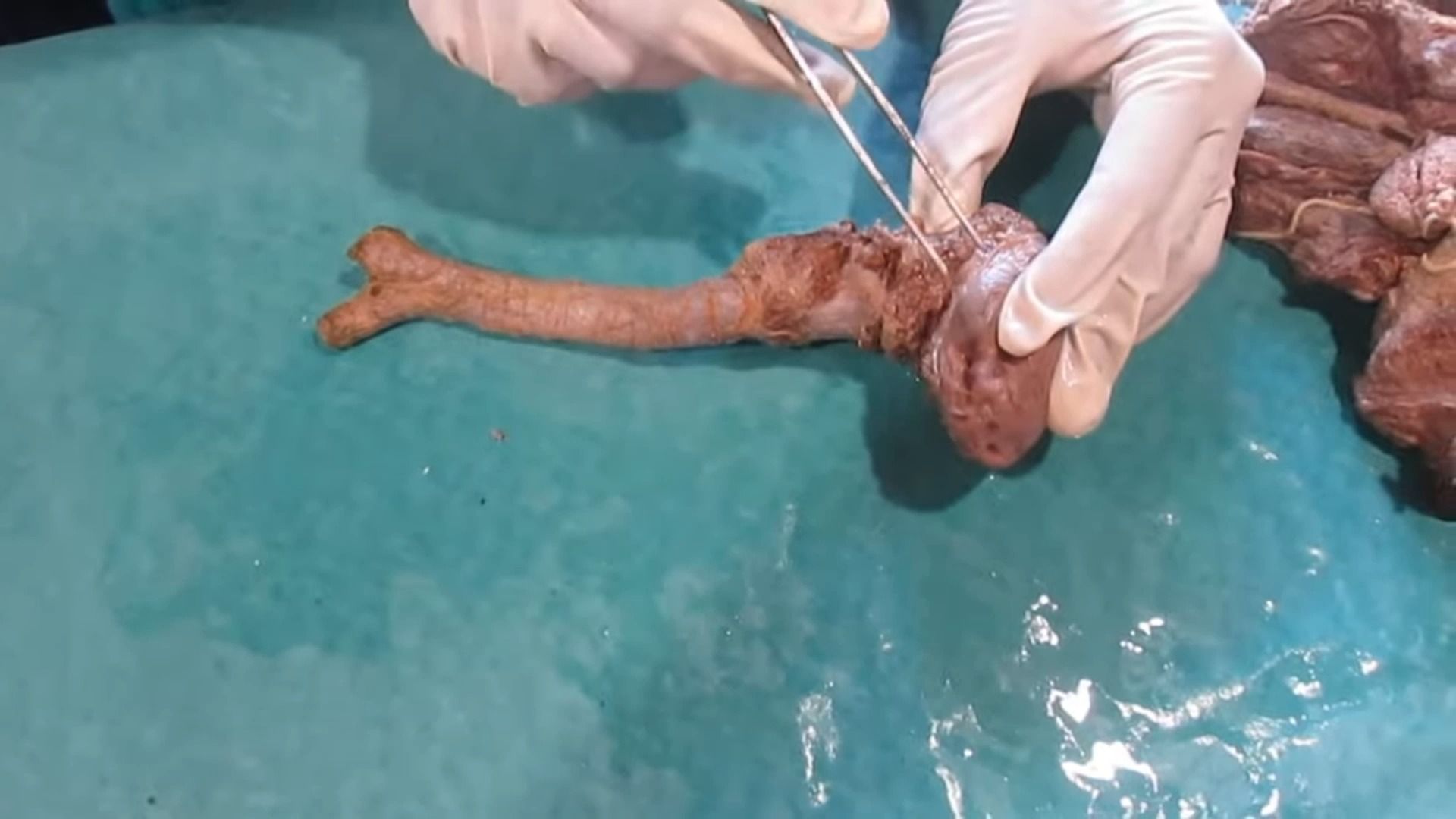 人类舌头和气管部分的标本