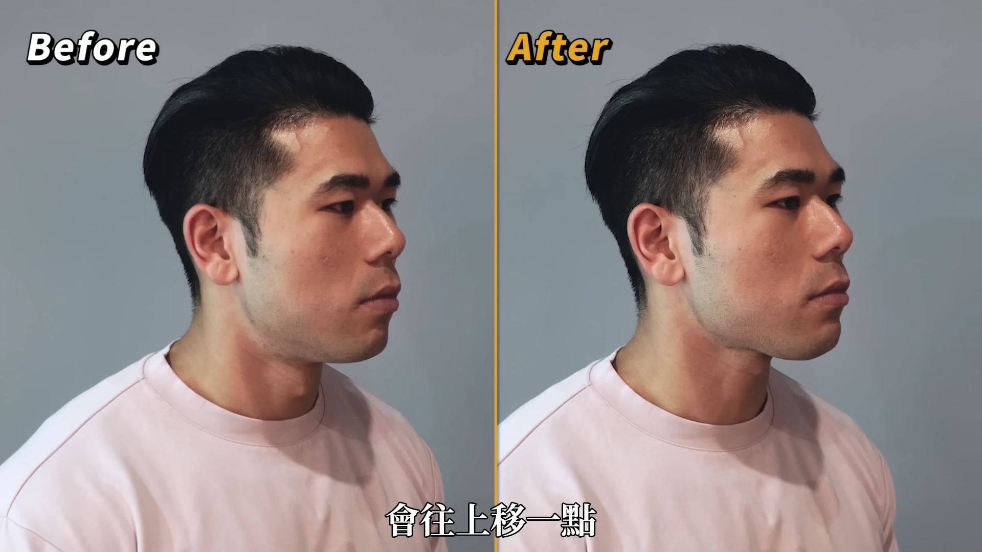 消除双下巴！牙医教你科学练出下颌线，高效瘦脸/改善脸型全教程