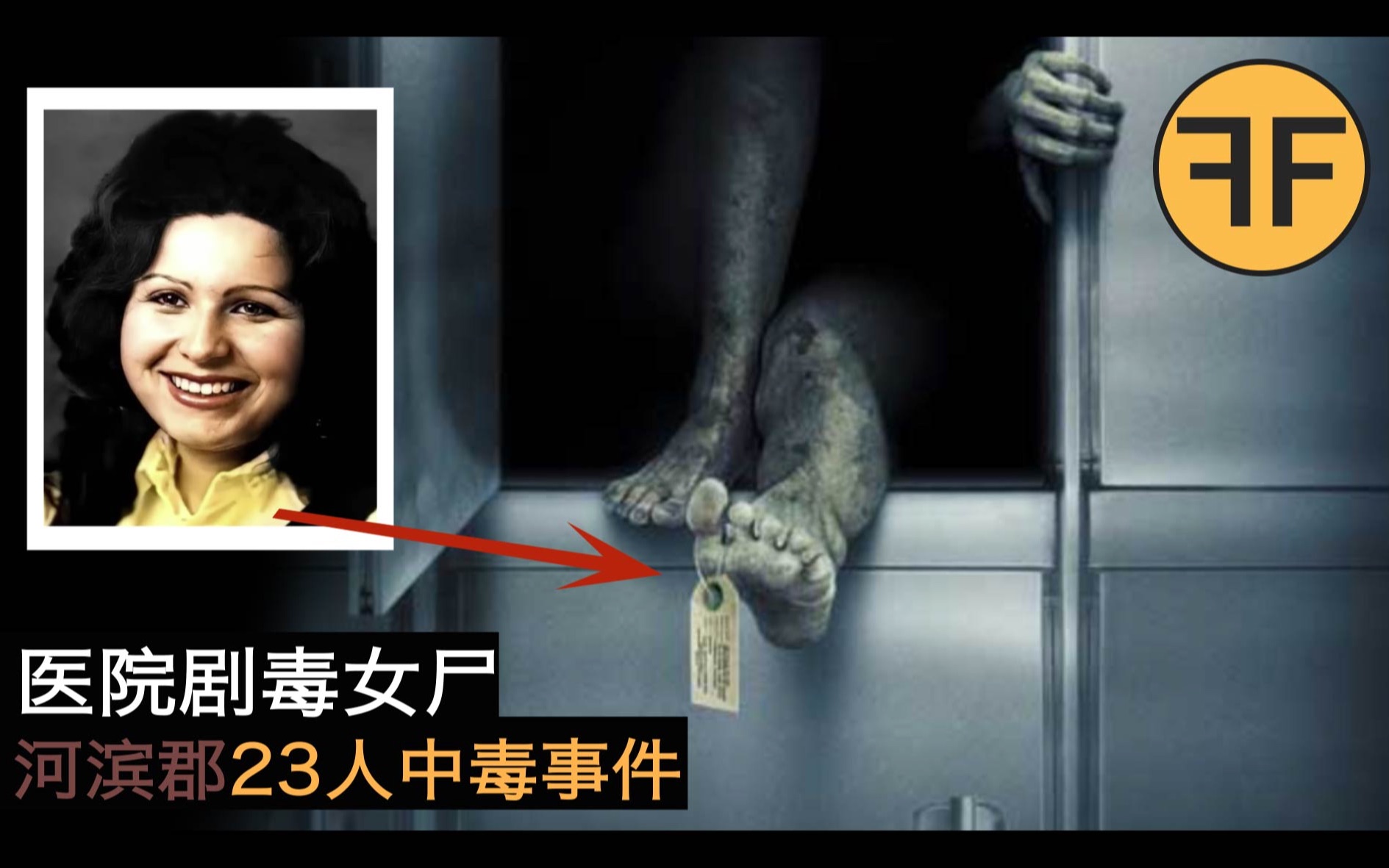 [图]28年诡异事件，神秘“剧毒女尸”诡异恶臭，一晚上放倒急救室23名医护人员