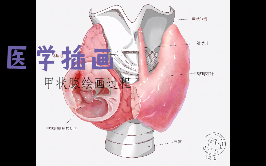 【医学插画绘画过程】甲状腺病损剖面+一些考研碎碎念【负能警告】哔哩哔哩bilibili