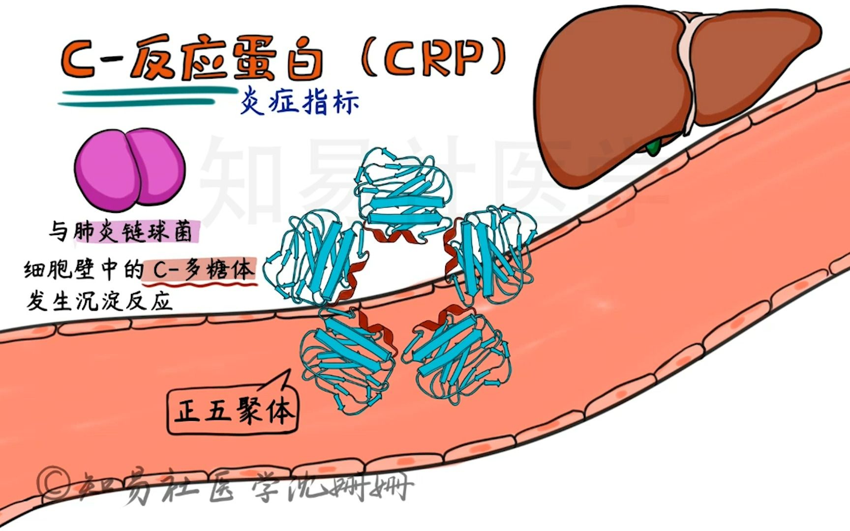 诊断学考点 什么是C反应蛋白 CRP哔哩哔哩bilibili