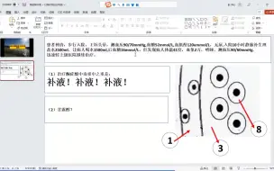 Video herunterladen: 碎嘴蛙讲-糖尿病酮症-2-补液