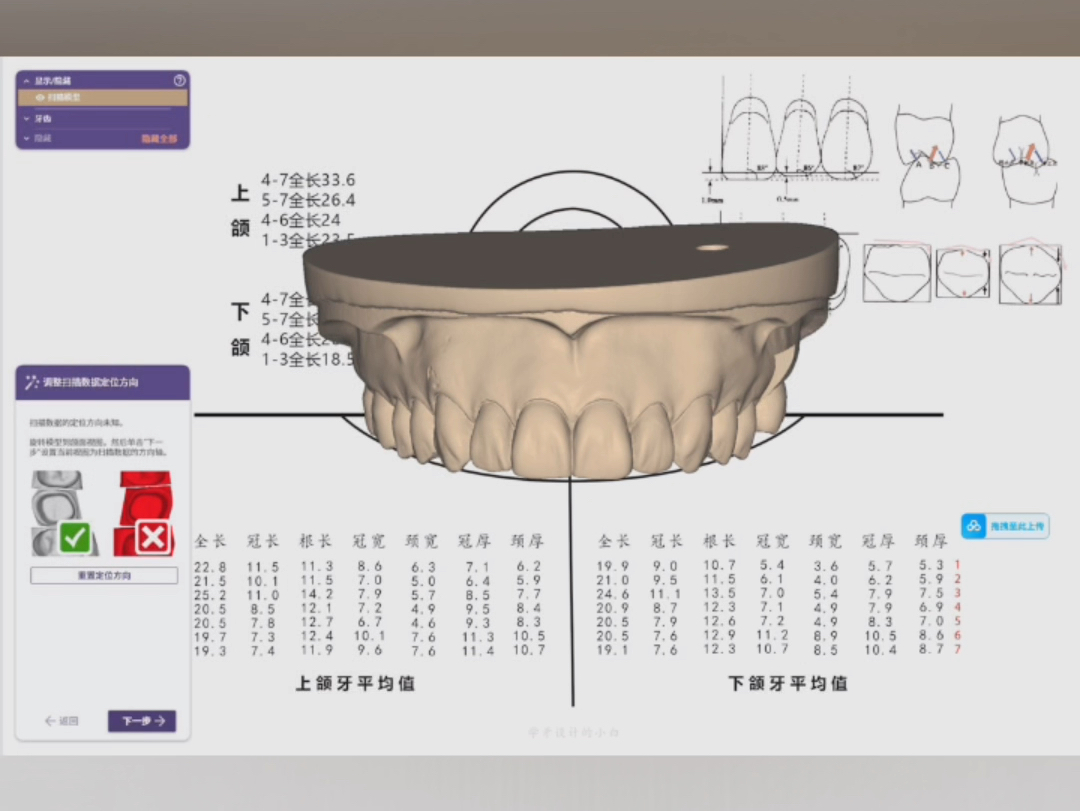 EXOCAD 数字化背景图 参考线哔哩哔哩bilibili