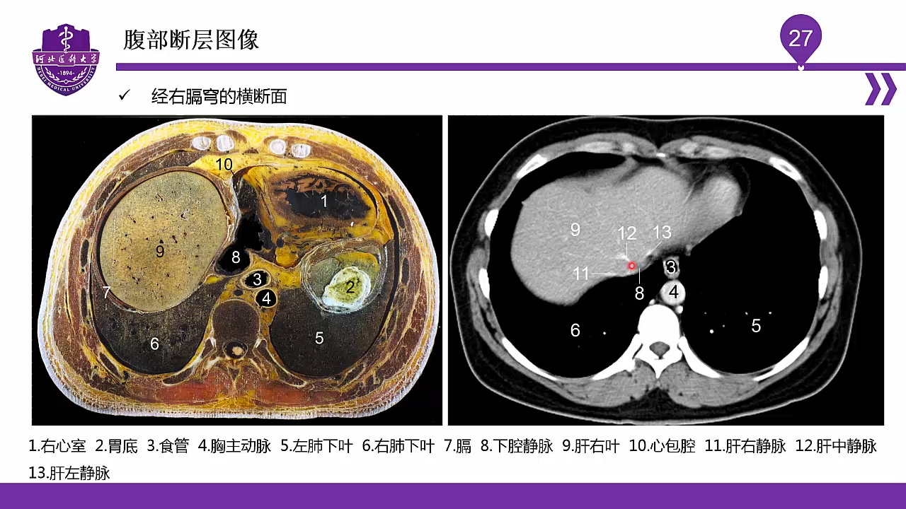 [图]023腹部断层标本与影像解剖一