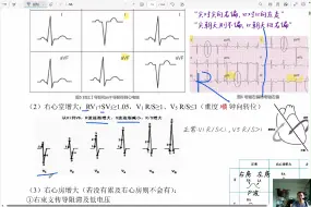 Download Video: 【二轮狂背】abandon*内科学·呼吸系统疾病*慢性肺心病