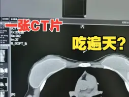 下载视频: 一张CT片子套多个病历！医生实名举报无锡虹桥医院涉嫌骗保