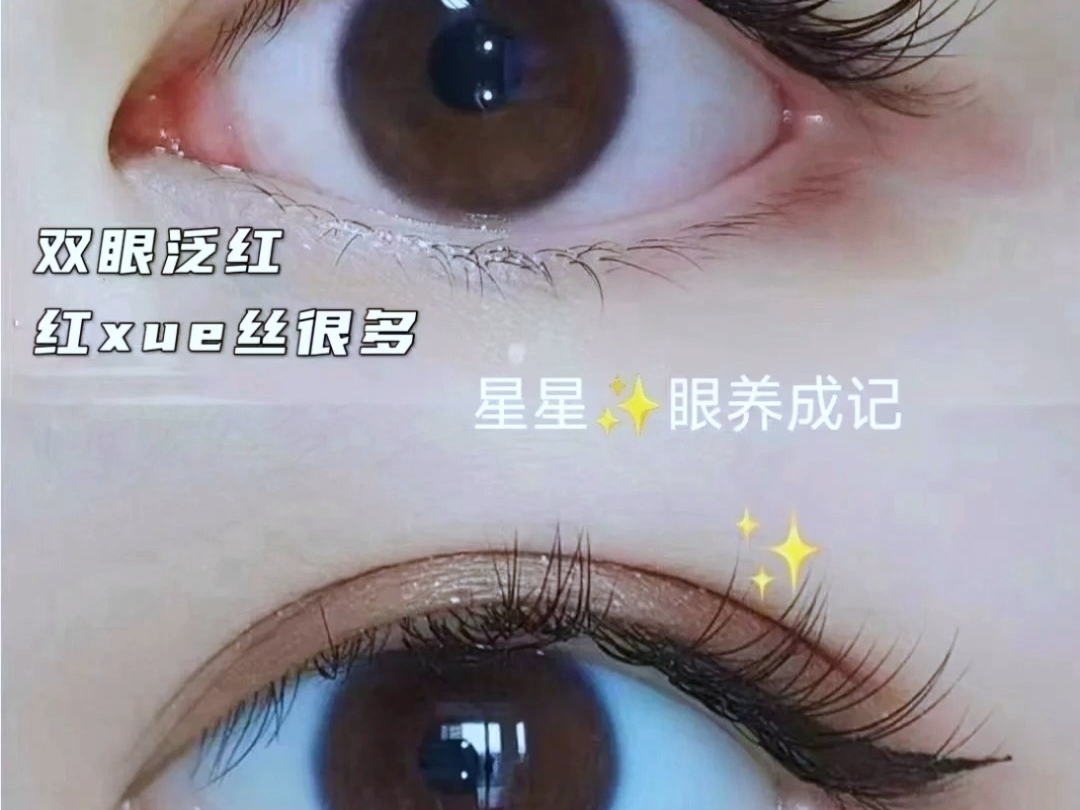 眼球抗衰哔哩哔哩bilibili