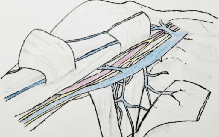 【liiii的头秃学医日志】局解绘图作业-腋窝