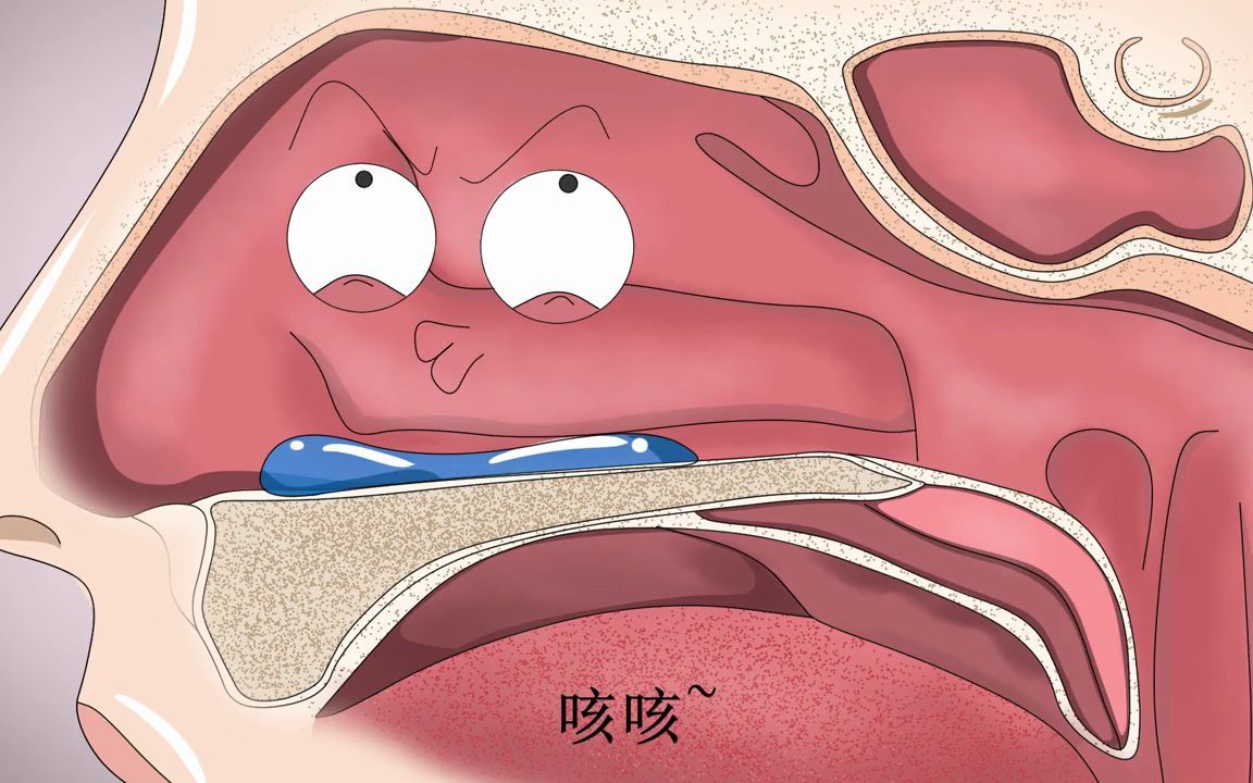 [图]南昌博大耳鼻喉：鼻腔被脓涕堵到了，鼻腔冲洗缓解鼻不通气情况