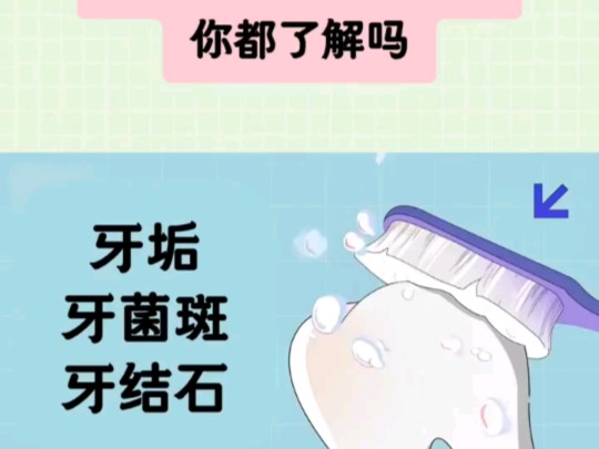 牙垢牙结石…哔哩哔哩bilibili