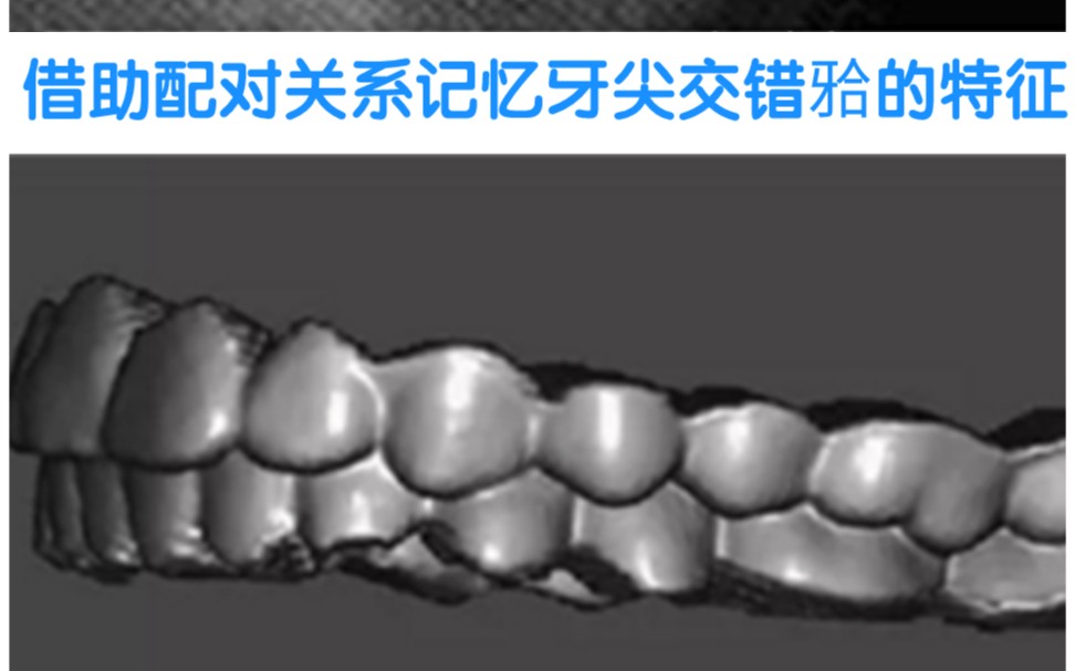 口腔解剖生理学 牙尖交错牙合的特征哔哩哔哩bilibili