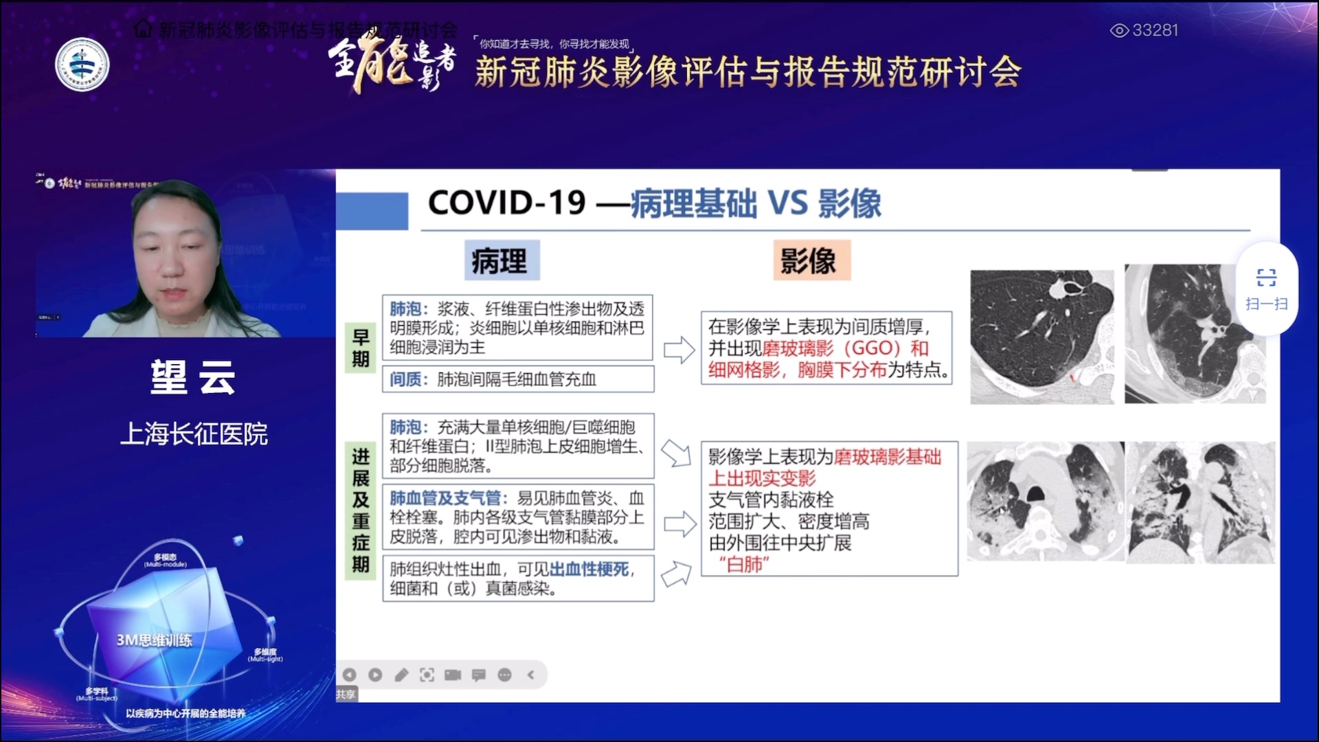 「 学习自用 」新冠肺炎CT表现与鉴别诊断(上海长征医院 望云教授)——2023年1月哔哩哔哩bilibili