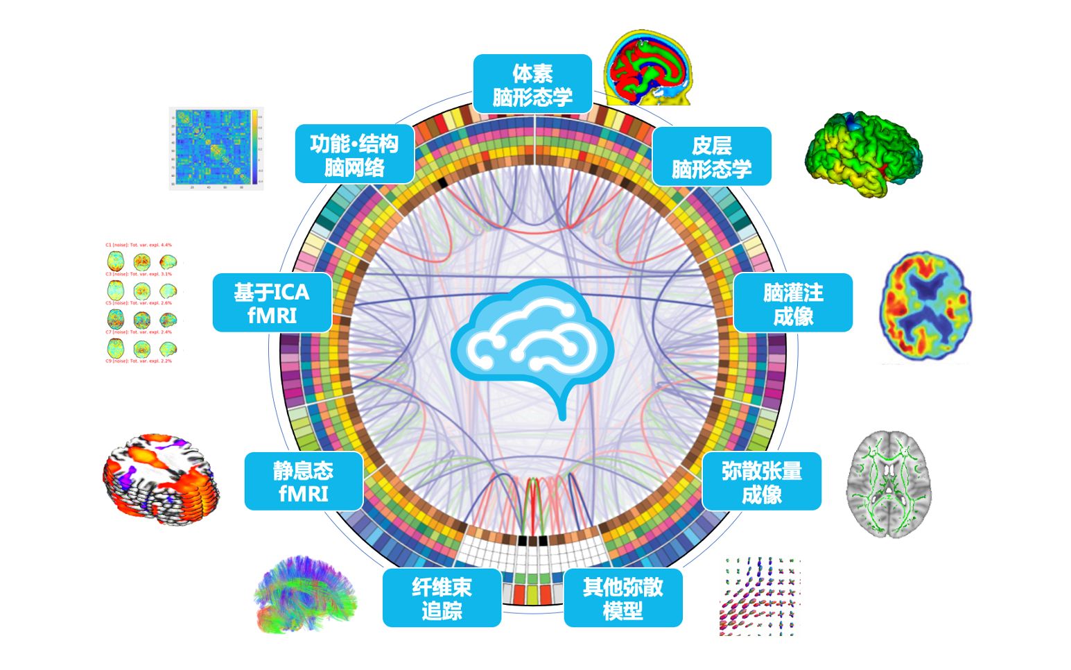 慧脑云脑影像数据处理系列讲座|SBM 概述哔哩哔哩bilibili