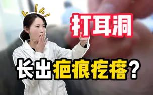 Download Video: 打耳洞后竟长出疤痕疙瘩，应该怎么办？