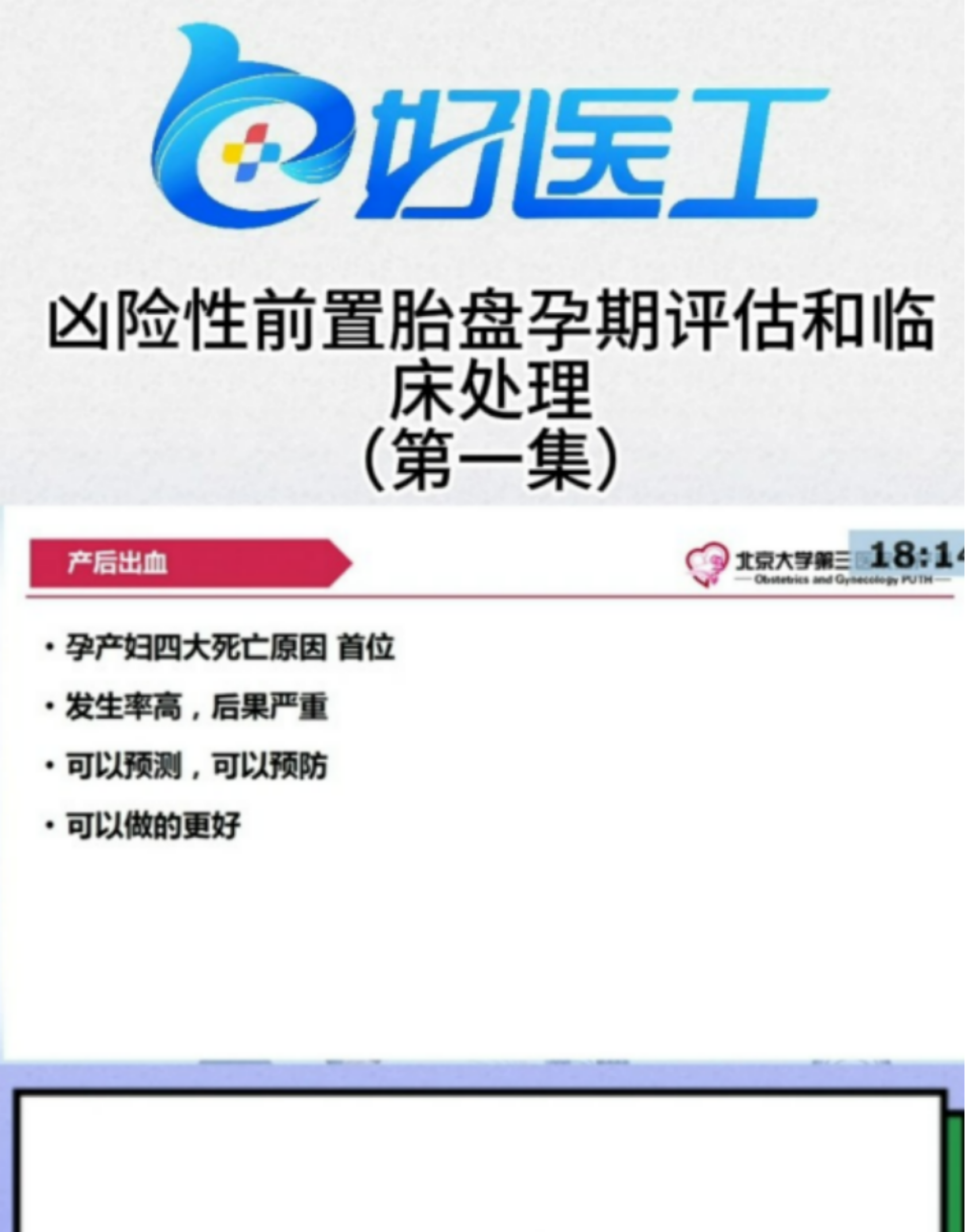 凶险性前置胎盘孕期评估和临床处理(第一集)哔哩哔哩bilibili