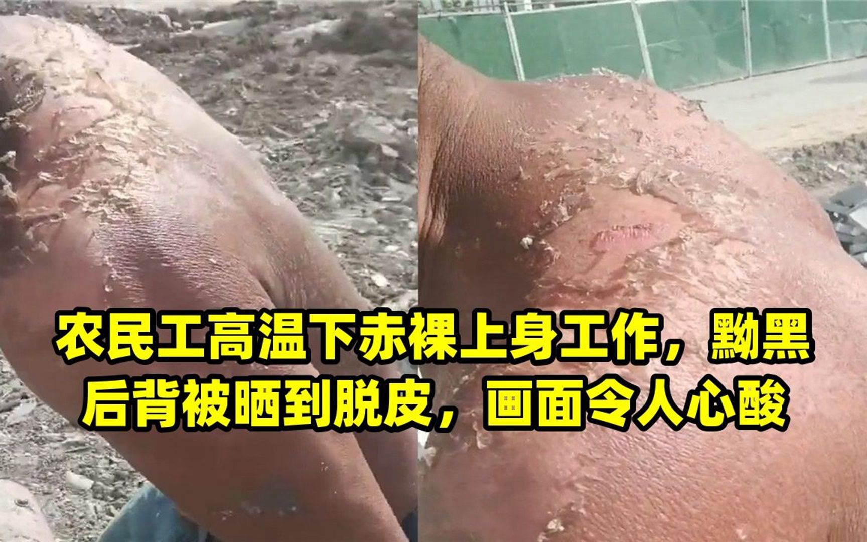 农民工高温下赤裸上身工作,黝黑后背被晒到脱皮,画面令人心酸哔哩哔哩bilibili