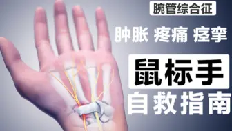 打工人自救指南：别轻视鼠标手，你知道鼠标手有多可怕吗 ？