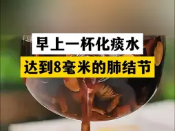 Télécharger la video: 早上一杯化痰水，达到8毫米的肺结节，也可能“自己跑”