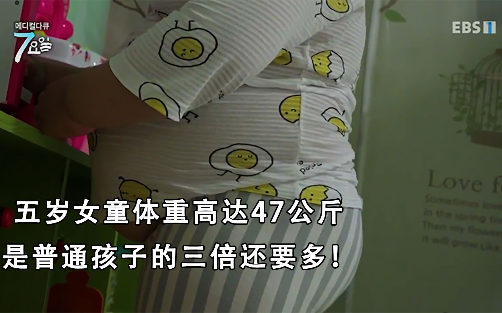 五岁女童体重高达47公斤是普通孩子的三倍还要多